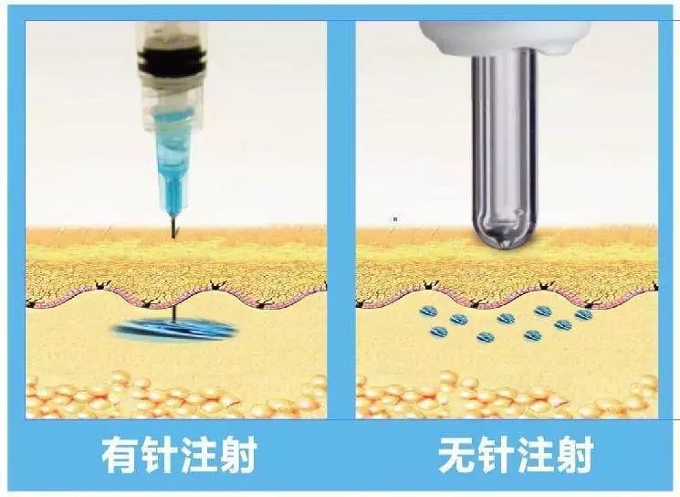 显卡gt745m GT745M 显卡：曾经的中小笔记本市场宠儿，如今虽已淡出但仍有功绩  第7张